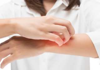 5 shocking reasons why mosquitoes bite you more... 5 shocking reasons why mosquitoes bite you more...