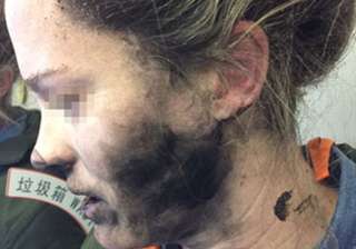 Female passenger suffers severe injuries after... Female passenger suffers severe injuries after...