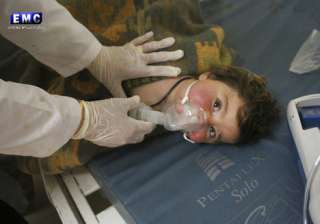 Chemical attack victim - India TV Chemical attack victim - India TV