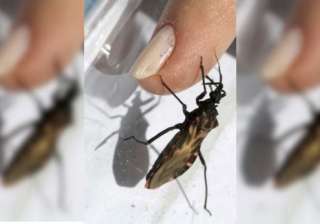 kissing bug cause death - India TV kissing bug cause death - India TV