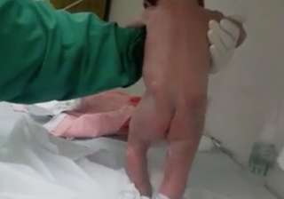 ‘Miracle Baby’ starts walking as soon as he’s born - India TV ‘Miracle Baby’ starts walking as soon as he’s born - India TV