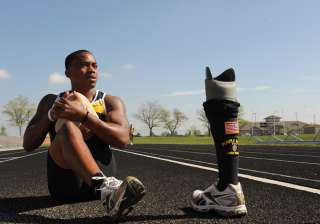 phantom limb pain - India TV phantom limb pain - India TV