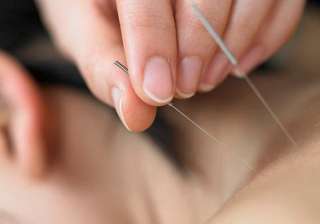 acupuncture for PCOS induced infertility - India TV acupuncture for PCOS induced infertility - India TV