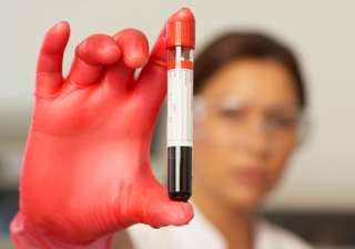 blood test can detect blood cancer five yrs early - India TV blood test can detect blood cancer five yrs early - India TV