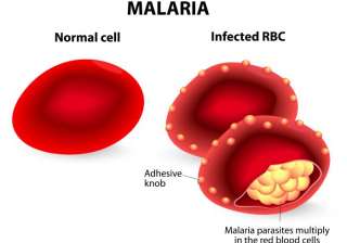 malaria - India TV malaria - India TV