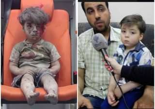 omraan daqneesh syria aleppo - India TV omraan daqneesh syria aleppo - India TV