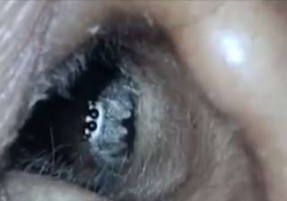 live spider crawls out of womans ear - India TV live spider crawls out of womans ear - India TV