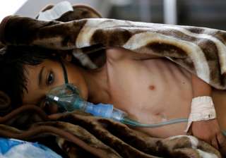 yemen cholera outbreak - India TV yemen cholera outbreak - India TV