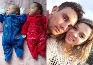 brain dead brazillian woman kept alive for 123 day - India TV brain dead brazillian woman kept alive for 123 day - India TV