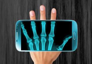 X rays cardiovascular diseases X rays cardiovascular diseases