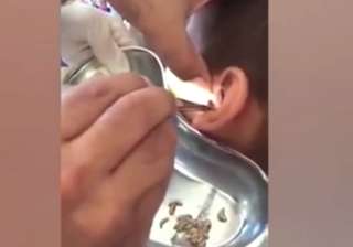 maggots in ear viral video - India TV maggots in ear viral video - India TV