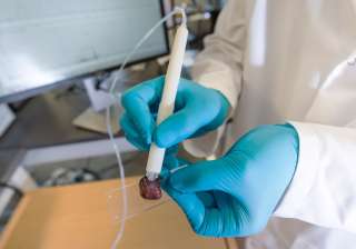 MasSpec pen cancer detection MasSpec pen cancer detection