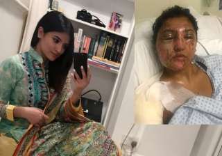 london model acid attack london model acid attack