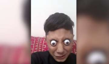 Pakistani Boy, Eye, Lahore, Viral Video Pakistani Boy, Eye, Lahore, Viral Video