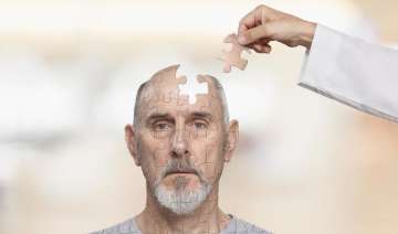 New Alzheimer's test can predict the age of... New Alzheimer's test can predict the age of...