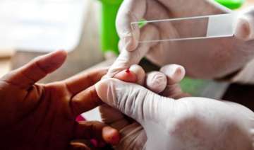 Delhi residents to get free diagnostic tests -... Delhi residents to get free diagnostic tests -...