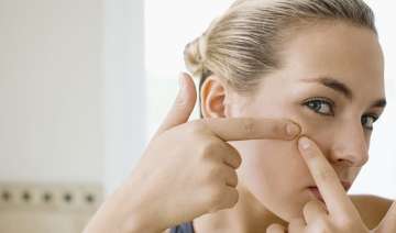 DIY remedy DIY remedy