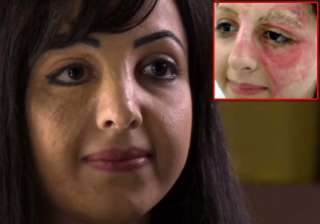 burnt at 3 basma hameed is a tattoo fairy for... burnt at 3 basma hameed is a tattoo fairy for...
