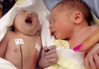 100 minute old baby teddy turns saviour donates... 100 minute old baby teddy turns saviour donates...
