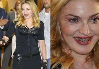omg madonna looks horrifying in those gold grills... omg madonna looks horrifying in those gold grills...