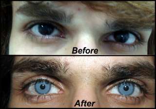 forget coloured lenses now get blue or green eyes... forget coloured lenses now get blue or green eyes...