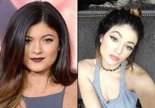 kylie jenner finally opens up on plastic surgery... kylie jenner finally opens up on plastic surgery...