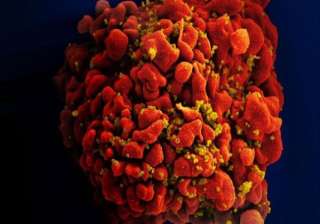 anti hiv antibody shows promise in first human... anti hiv antibody shows promise in first human...