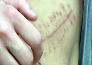 boy in china sells kidney to buy iphone ipad -... boy in china sells kidney to buy iphone ipad -...