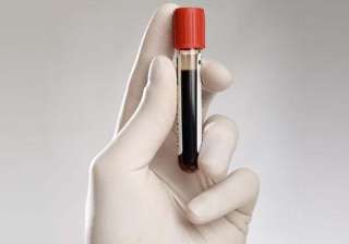 10 new antibodies found against cancer - India TV 10 new antibodies found against cancer - India TV