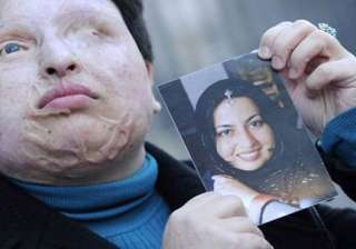 iran eye for an eye acid attack postponed - India... iran eye for an eye acid attack postponed - India...