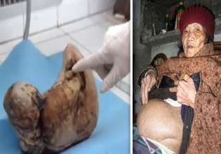 know the woman in morocco who underwent pregnancy... know the woman in morocco who underwent pregnancy...