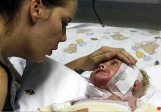 south africa cloned skin recipient to leave... south africa cloned skin recipient to leave...