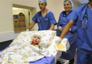 south african girl gets new layer of cloned skin... south african girl gets new layer of cloned skin...