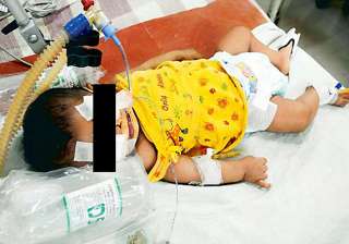 baby afreen still critical - India TV baby afreen still critical - India TV
