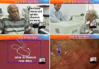 believe it or not 15 cm live worm pulled out of... believe it or not 15 cm live worm pulled out of...