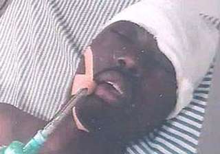 burundi student who was brutally attacked in... burundi student who was brutally attacked in...