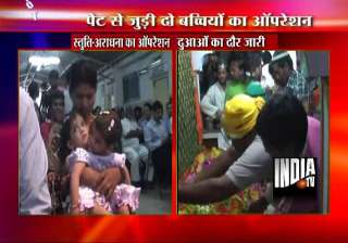 surgeons from india abroad separate conjoined... surgeons from india abroad separate conjoined...