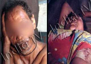 dalit couple s eyes pierced with scissors in... dalit couple s eyes pierced with scissors in...
