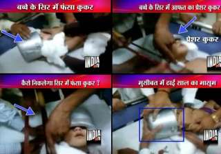 delhi docs use cutter saw to extricate child s... delhi docs use cutter saw to extricate child s...