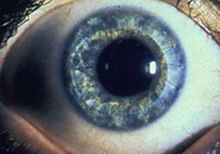 eye care institute performs 20 000 corneal... eye care institute performs 20 000 corneal...