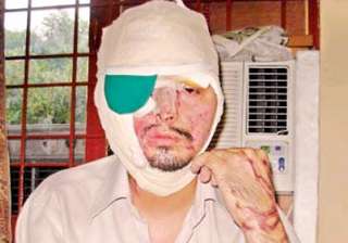 girl throws acid on lover s face out on bail -... girl throws acid on lover s face out on bail -...