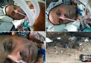jodhpur hospital rat bite case probe committee... jodhpur hospital rat bite case probe committee...