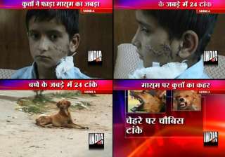 shimla boy gets 24 stitches after stray dogs... shimla boy gets 24 stitches after stray dogs...