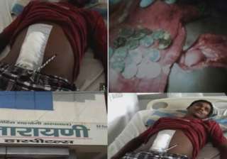 17 coins extracted from youth s stomach in up -... 17 coins extracted from youth s stomach in up -...