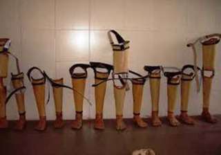 1 000 amputees in afghanistan to get jaipur foot... 1 000 amputees in afghanistan to get jaipur foot...