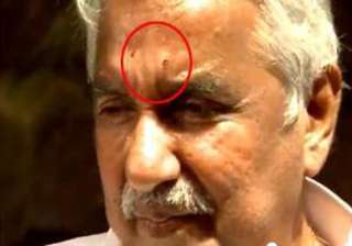 chandy injured in stone pelting cpi m rules out... chandy injured in stone pelting cpi m rules out...