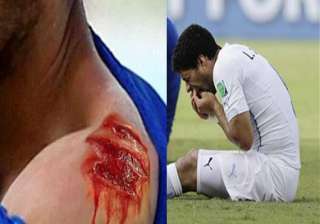 luis suarez biting giorgio chiellini generates... luis suarez biting giorgio chiellini generates...