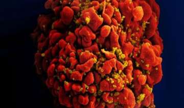 anti hiv antibody shows promise in first human... anti hiv antibody shows promise in first human...