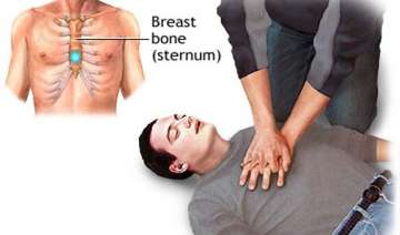 cardiac arrest can be controlled by cpr expert -... cardiac arrest can be controlled by cpr expert -...