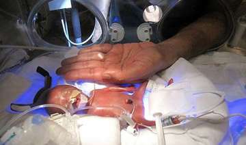 indian doc in us oversees birth of world s... indian doc in us oversees birth of world s...